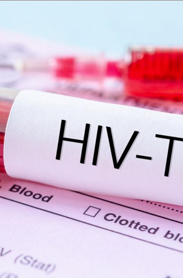 Miasto przekaże 10 tysięcy zł na bezpłatne, anonimowe badania na HIV